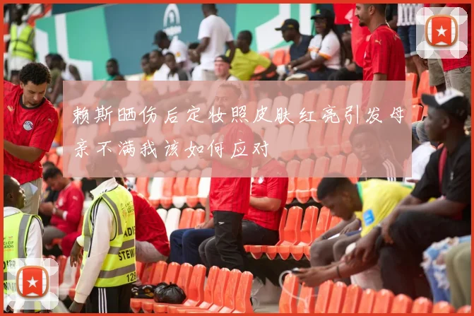 赖斯晒伤后定妆照皮肤红亮引发母亲不满我该如何应对
